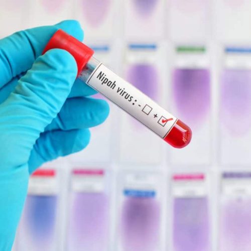 Nipah-1-1024x683-1
