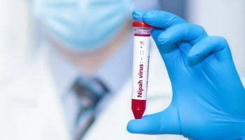 virus-nipah-1024x565-1
