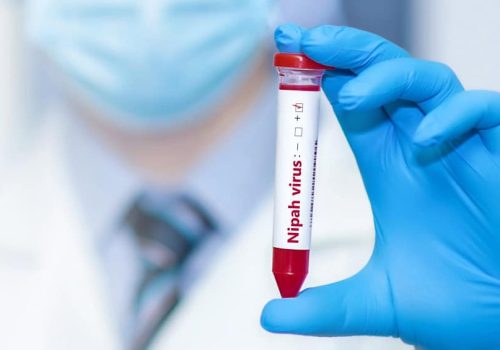 virus-nipah-1024x565-1